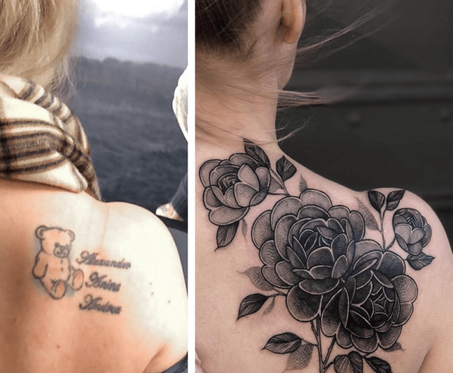Détatouage les différentes techniques pour retirer son tattoo
